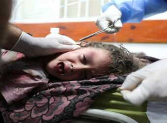Ραγίζει καρδιές η 13χρονη Λαγιάν στη Λωρίδα της Γάζας: «Ξαναβάλτε μου τα πόδια μου – Πώς θα επιστρέψω στο σχολείο όταν οι φίλες μου θα περπατάνε κι εγώ όχι;»